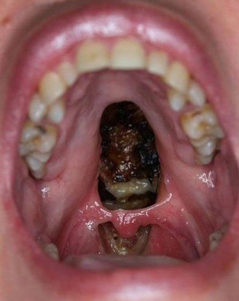 这位名为霍华德法兰(howard farran)的牙医想借这些"重口味"照片警示