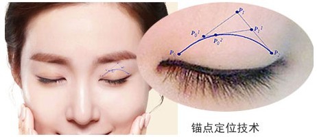 贝塞尔曲线原理 在双眼皮手术应用中的优势__