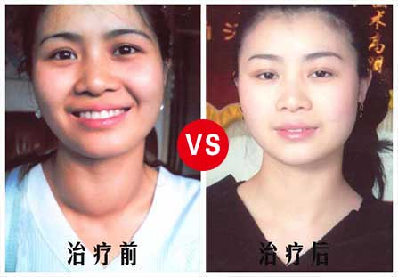 北京华北甲状腺医院发展事迹